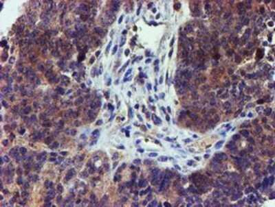Immunohistochemistry: LECT2 Antibody (OTI2A11) - Azide and BSA Free [NBP2-71122]
