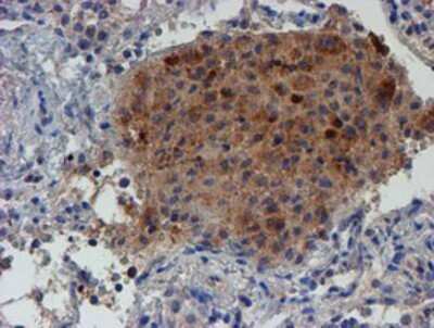 Immunohistochemistry: LECT2 Antibody (OTI2A11) - Azide and BSA Free [NBP2-71122]