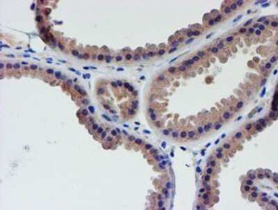 Immunohistochemistry: LECT2 Antibody (OTI2A11) - Azide and BSA Free [NBP2-71122]