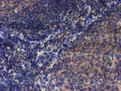 Immunohistochemistry: LECT2 Antibody (OTI2A11) - Azide and BSA Free [NBP2-71122]