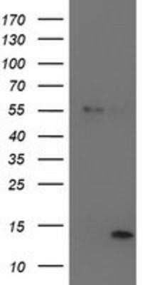 Western Blot: LECT2 Antibody (OTI2A11)Azide and BSA Free [NBP2-71122]