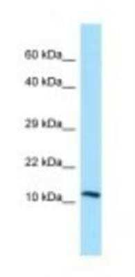 Western Blot: LECT2 Antibody [NBP1-98454]