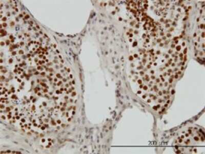 Immunohistochemistry-Paraffin: LEDGF Antibody (3H1) [H00011168-M01]