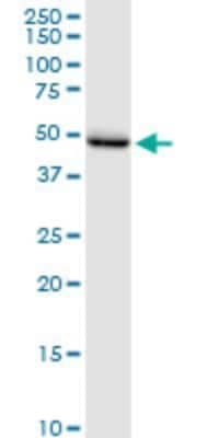 Western Blot: LEDGF Antibody (3H1) [H00011168-M01]