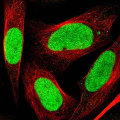 Immunocytochemistry/ Immunofluorescence: LEDGF Antibody [NBP1-87885]