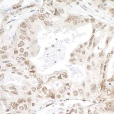 Immunohistochemistry-Paraffin: LEDGF Antibody [NB110-40560]