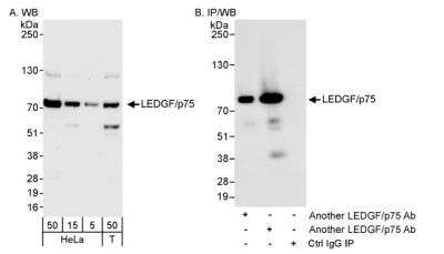 Western Blot: LEDGF Antibody [NB110-40561]