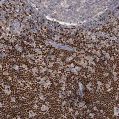 Immunohistochemistry-Paraffin: LEF1 Antibody [NBP1-86960]