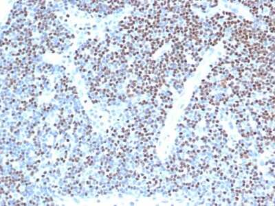 Immunohistochemistry-Paraffin: LEF1 Antibody (LEF1/341R) - Azide and BSA Free [NBP3-08435]