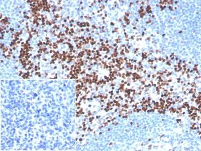 Immunohistochemistry-Paraffin: LEF1 Antibody (LEF1/341R) [NBP3-07769]