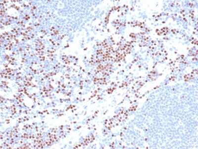 Immunohistochemistry-Paraffin: LEF1 Antibody (LEF1/422R) - Azide and BSA Free [NBP3-08519]