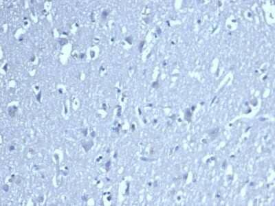 Immunohistochemistry-Paraffin: LEF1 Antibody (LEF1/422R) - Azide and BSA Free [NBP3-08519]