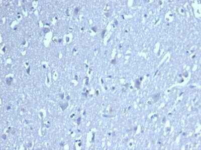 Immunohistochemistry-Paraffin: LEF1 Antibody (LEF1/422R) [NBP3-07783]