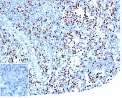 Immunohistochemistry-Paraffin: LEF1 Antibody (rLEF1/6906) [NBP3-13994]