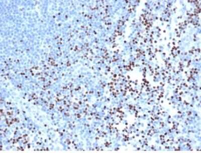 Immunohistochemistry-Paraffin: LEF1 Antibody (rLEF1/6906) [NBP3-13994]