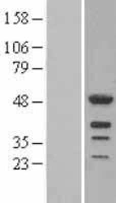 Western Blot: LEF1 Overexpression Lysate [NBL1-12484]