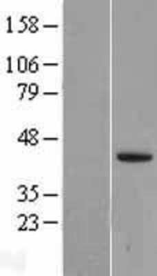 Western Blot: Lefty-2 Overexpression Lysate [NBL1-12485]