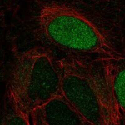 Immunocytochemistry/ Immunofluorescence: LEKR1 Antibody [NBP3-17390]