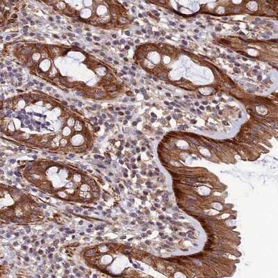 Immunohistochemistry-Paraffin: LEKR1 Antibody [NBP1-93995]