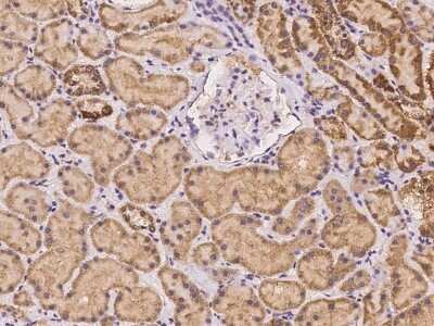 Immunohistochemistry-Paraffin: LEKR1 Antibody [NBP3-06248]