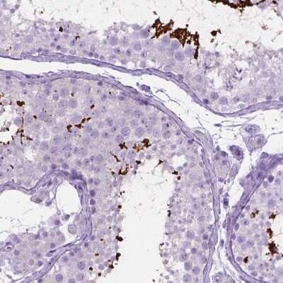 Immunohistochemistry-Paraffin: LELP1 Antibody [NBP2-49624]