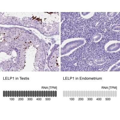 Immunohistochemistry-Paraffin: LELP1 Antibody [NBP2-49624]