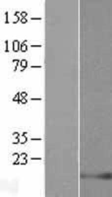 Western Blot: LELP1 Overexpression Lysate [NBP2-08763]