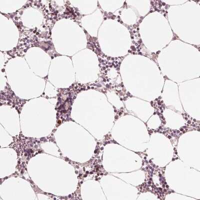 Immunohistochemistry-Paraffin: LEM3 Antibody [NBP2-57961]