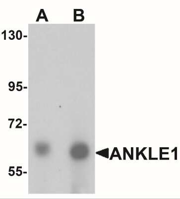 Western Blot: LEM3 AntibodyBSA Free [NBP2-41144]