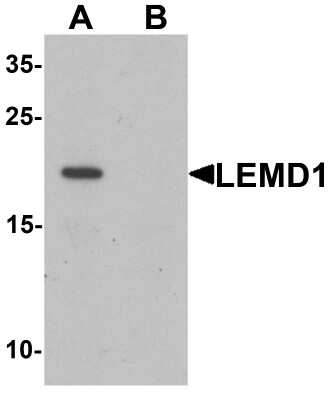 Western Blot: LEMD1 AntibodyBSA Free [NBP2-81920]