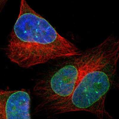 Immunocytochemistry/ Immunofluorescence: LEMD2 Antibody [NBP1-85175]