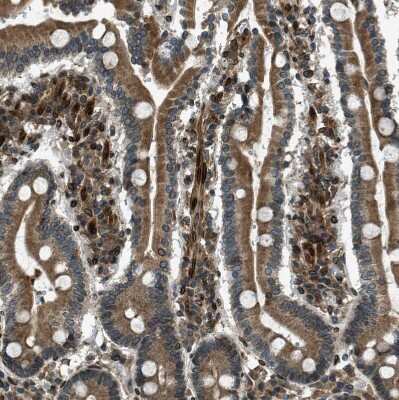 Immunohistochemistry-Paraffin: LEMD2 Antibody [NBP1-85175]