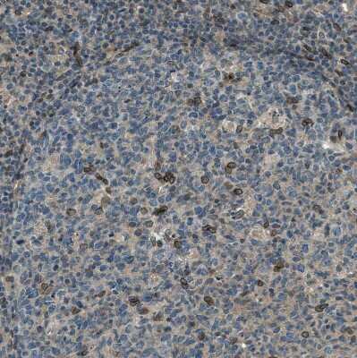 Immunohistochemistry-Paraffin: LEMD2 Antibody [NBP1-85175]