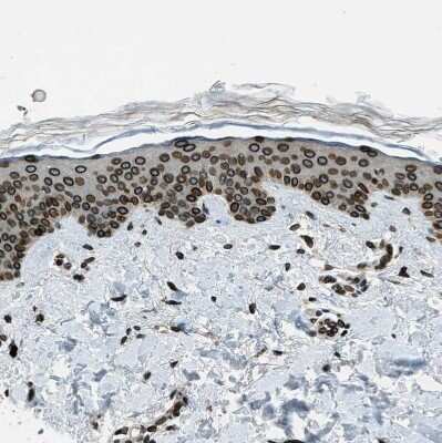 Immunohistochemistry-Paraffin: LEMD2 Antibody [NBP1-85175]
