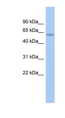 Western Blot: LEMD2 Antibody [NBP1-70598]