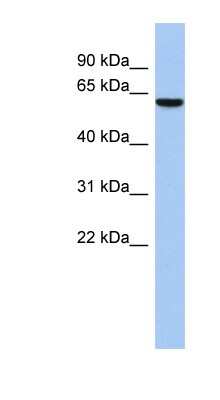 Western Blot: LEMD2 Antibody [NBP1-70599]