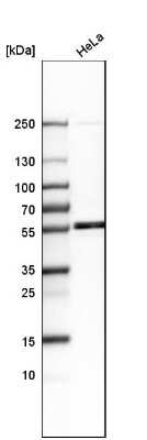 Western Blot: LEMD2 Antibody [NBP1-85175]