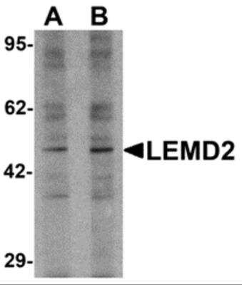 Western Blot: LEMD2 AntibodyBSA Free [NBP2-82103]