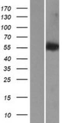 Western Blot: LEMD2 Overexpression Lysate [NBP2-04930]