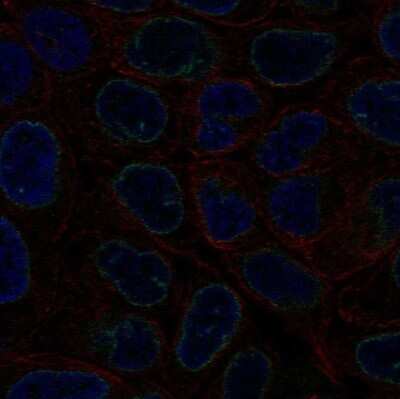 Immunocytochemistry/ Immunofluorescence: LEMD3 Antibody [NBP2-57649]