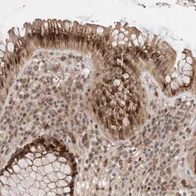 Immunohistochemistry-Paraffin: LEMD3 Antibody [NBP1-81265]