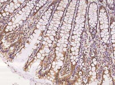 Immunohistochemistry-Paraffin: LEMD3 Antibody [NBP3-05823]