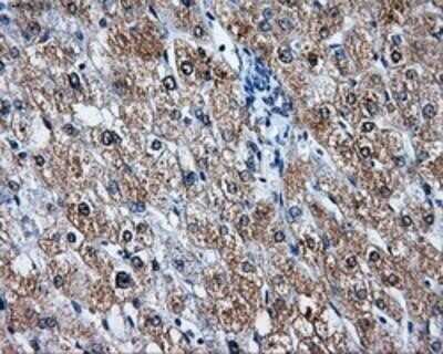 Immunohistochemistry: LEMD3 Antibody (OTI6C10) - Azide and BSA Free [NBP2-71744]