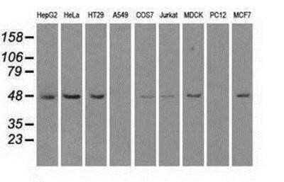 Western Blot: LEMD3 Antibody (OTI6C10)Azide and BSA Free [NBP2-71744]