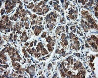 Immunohistochemistry-Paraffin: LEMD3 Antibody (OTI6C10) [NBP2-02211]