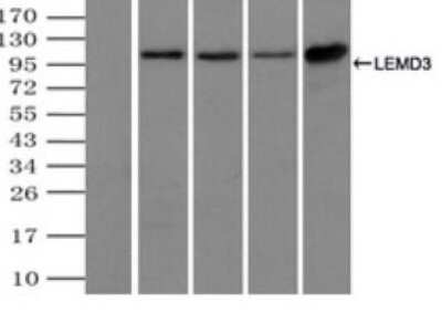 Immunoprecipitation: LEMD3 Antibody (OTI6C10) [NBP2-02211]