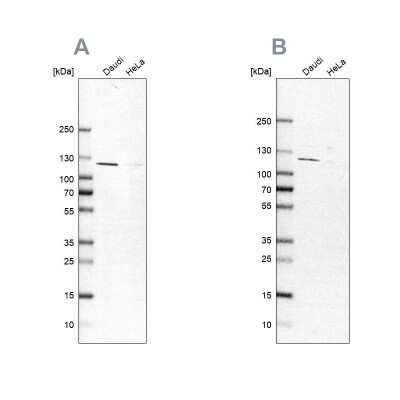 Western Blot: LEMD3 Antibody [NBP2-57649]