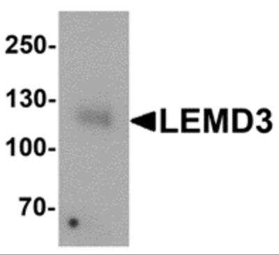 Western Blot: LEMD3 AntibodyBSA Free [NBP2-82104]