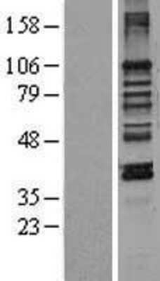 Western Blot: LEMD3 Overexpression Lysate [NBL1-12486]