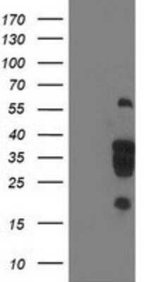 Western Blot: LENG1 Antibody (OTI10A7) [NBP2-00915]